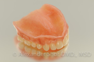 Complete Denture by Seattle Prosthodontist, Shor Dental, Alexander Shor Seattle